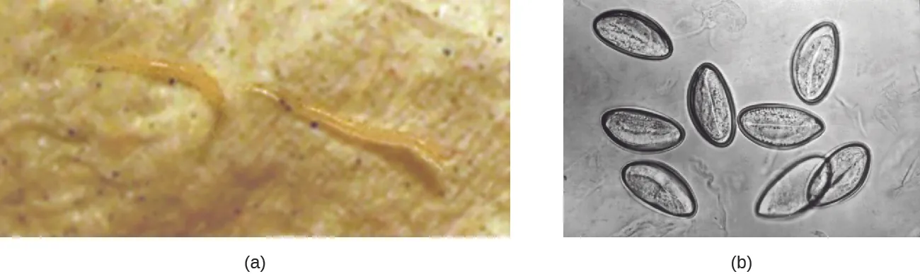 a) photo of a small clear worm. B) micrograph of cells shaped like pointed ovals.