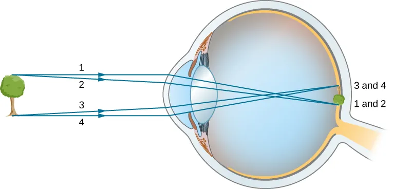 Figure shows a tree in front of an eye. Rays from the top and bottom of the tree strike the cornea of the eye. They are refracted, intersect in the middle of the vitreous humor and reach the retina. The image formed on the retina is tiny and inverted.