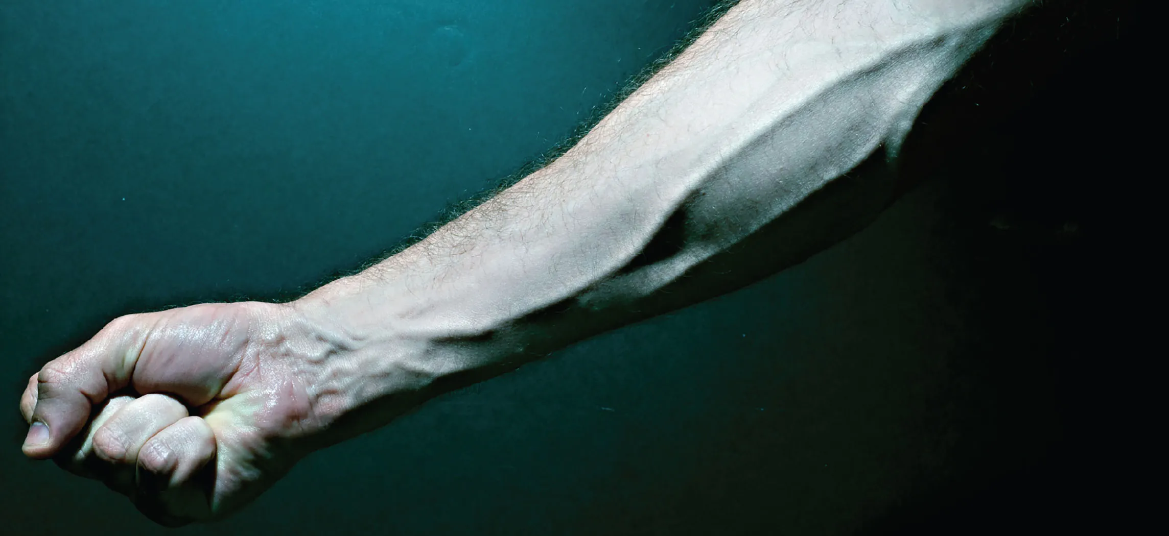 This photo shows a forearm with the veins bulging.