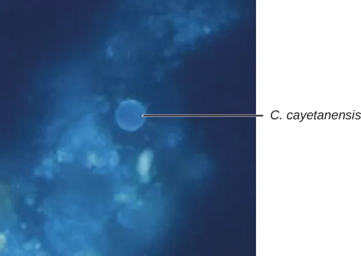 Micrograph of a blue glowing sphere labeled C. cayetanensis on a black background.