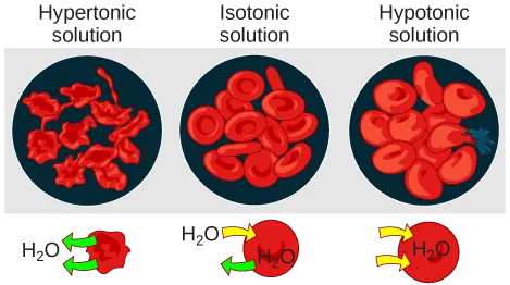 Illustration of red blood cells in hypotonic, isotonic, and hypertonic solutions. In the hypertonic solution, the cells shrivel and take on a spiky appearance. In the isotonic solution, the cells are normal in appearance. In the hypotonic solution, the cells swell and one has ruptured.