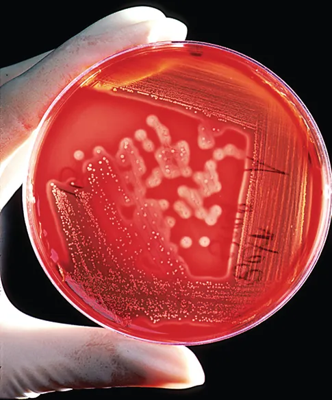 A photo shows a gloved hand holding a petri dish with circular bacteria colonies growing in the growth medium.
