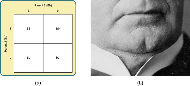 Image (a) is a Punnett square showing the four possible combinations (Bb, bb, Bb, bb) resulting from the pairing of a bb parent and a Bb parent. Image (b) is a close-up photograph showing a cleft chin.