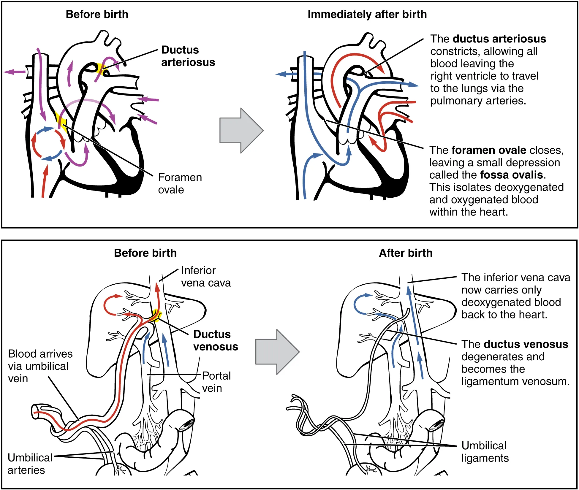 This figure illustrates the circulatory system in a newborn. The left image in both panels shows the blood circulation before birth and the right image shows the blood circulation after birth.
