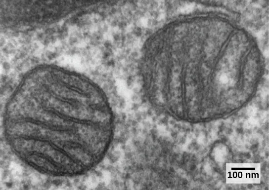 The transmission electron micrograph shows two round, membrane-bound organelles inside a cell. The organelles are about 400 nm across and have membranes running through the middle of them.