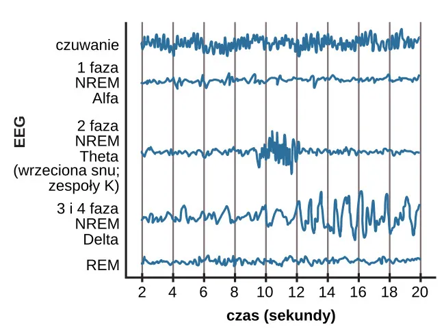 A graph has a y-axis labeled “EEG” and an x-axis labeled “time (seconds.) Plotted along the y-axis and moving upward are the stages of sleep. First is REM, followed by Stage 3 and 4 NREM Delta, Stage 2 NREM Theta (sleep spindles; K-complexes), Stage 1 NREM Alpha, and Awake. Charted on the x axis is Time in seconds from 2–20 in 2 second intervals. Each sleep stage has associated wavelengths of varying amplitude and frequency. Relative to the others, “awake” has a very close wavelength and a medium amplitude. Stage 1 is characterized by a generally uniform wavelength and a relatively low amplitude which doubles and quickly reverts to normal every 2 seconds. Stage 2 is comprised of a similar wavelength as stage 1. It introduces the K-complex from seconds 10 through 12 which is a short burst of doubled or tripled amplitude and decreased wavelength. Stages 3 and 4 have a more uniform wave with gradually increasing amplitude. Finally, REM sleep looks much like stage 2 without the K-complex.