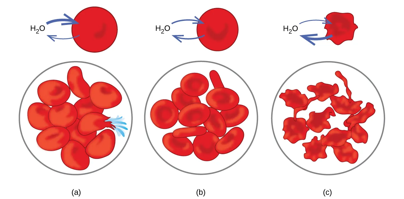 Esta figura muestra tres escenarios relacionados con las membranas de los glóbulos rojos. En a, el H subíndice 2 O tiene dos flechas dibujadas que apuntan a un disco rojo. Debajo de él, en un círculo, hay once discos similares con aspecto abultado, uno de los cuales parece haber estallado con un líquido azul que sale de él. En b, la imagen es similar, excepto que en lugar de tener dos flechas apuntando hacia el disco rojo, una apunta hacia adentro y una segunda apunta hacia afuera, hacia el H subíndice 2 O. En el círculo de abajo, hay doce de los discos rojos. En c, ambas flechas van desde un disco arrugado rojo hacia el H subíndice 2 O. En el círculo de abajo, se muestran doce discos arrugados.