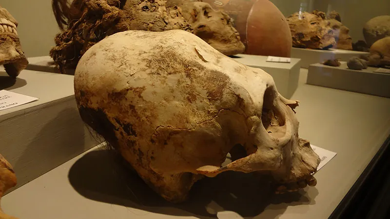 Unusually shaped skull on display in a museum. The back of the skull is much longer and larger than in a typical skull.