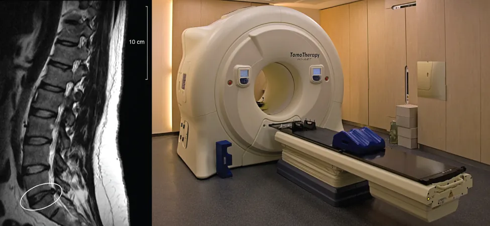 La imagen de la izquierda muestra una imagen de la columna vertebral humana tomada mediante resonancia magnética. La imagen de la izquierda es una fotografía del instrumento de resonancia magnética.