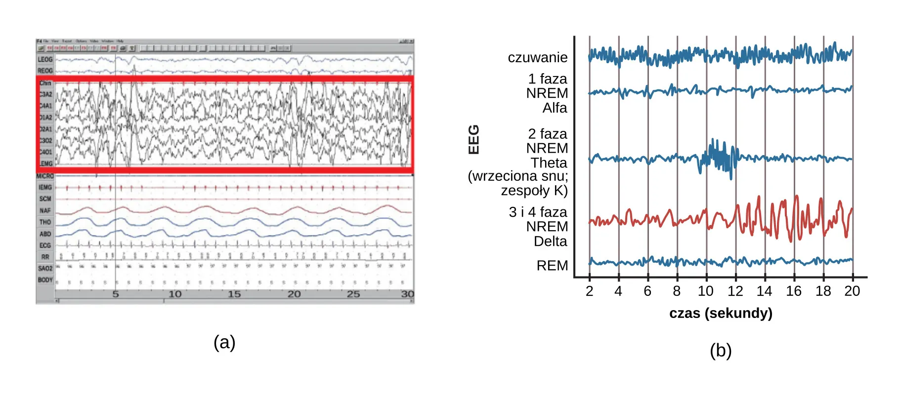 Polysonograph a shows the pattern of delta waves, which are low frequency and high amplitude. Delta waves are found mostly in stages 3 and 4 of sleep. Chart b shows brainwaves at various stages of sleep, with stages 3 and 4 highlighted.
