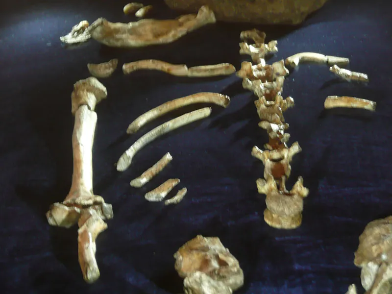 Collection of bones, including a portion of a spine.
