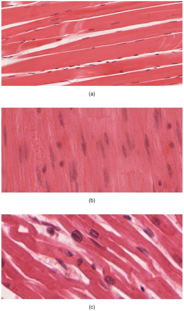 This shows three micrographs, each depicting one of the three muscle tissues. Picture A shows skeletal muscle tissue, which is dense strips of pink tissue that somewhat resemble bacon in appearance. Many small nuclei are dispersed throughout the tissues. The nuclei are flat and elongated, with multiple nuclei clustered into each cell. Picture B shows smooth muscle, which is densely packed and looks similar to skeletal muscle except that each cell only has one oval-shaped nucleus. Picture C shows cardiac muscle. Unlike skeletal and smooth muscle cells, cardiac muscle cells are not densely packed. The cardiac cells are branched, creating a large amount of space between each muscle cell. 