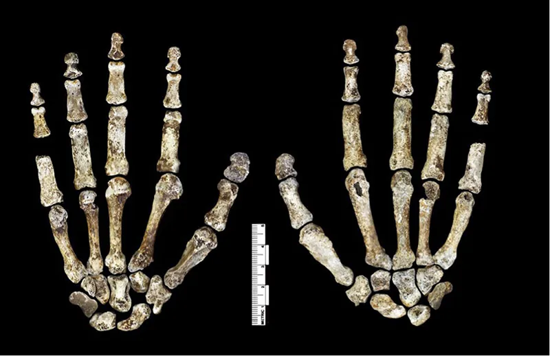 Left and right hand bones.