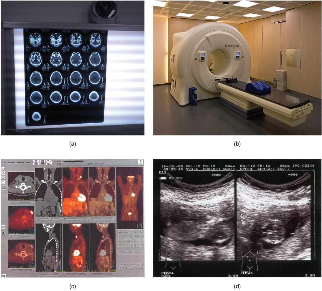 These photos shows four types of imaging equipment. Photo A, the results of a CT scan, shows 17 different transverse views of the skull, each taken at a different depth along the superior-inferior axis. The images are translucent, similar to an X ray, and are viewed on a light board. Photo B shows an MRI machine, which is a large drum into which lying patients enter via a conveyor belt. Photo C shows computer images of the body taken with PET scans. This produces anterior, lateral, posterior, and transverse views of the body that reveal the structure of the internal organs. Photo D shows an ultrasound readout, which is black and white. The image depicts solid tissues as light areas and empty space as dark areas. Some of the features of a young fetus can be seen in the empty space at the center of the image. The space containing the fetus is surrounded by the solid tissue of the uterus.