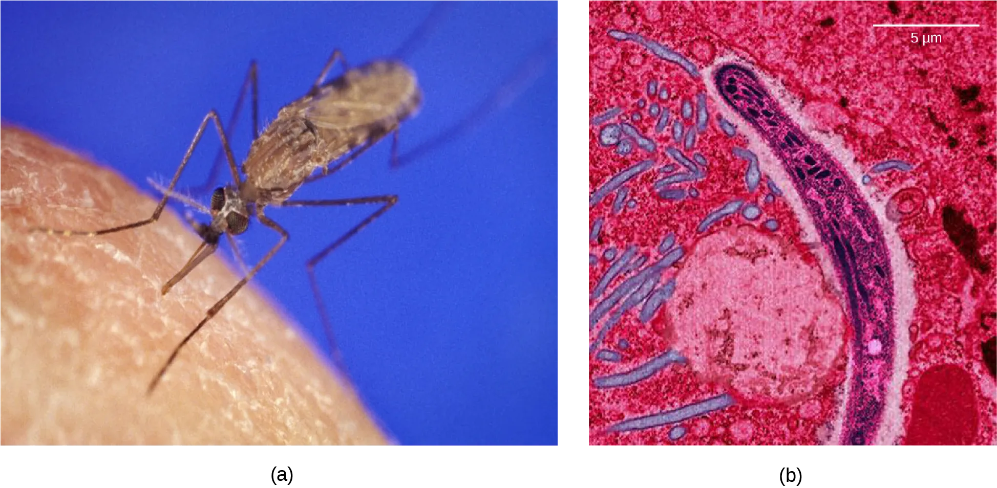 Photo a shows the Anopheles gambiae mosquito, which carries malaria. Photo b shows a micrograph of sickle-shaped Plasmodium falciparum, the parasite that causes malaria. The Plasmodium is about 0.75 microns across.