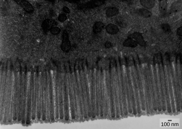 A micrograph shows tissue with an upper half that is grainy and a bottom half that consists of long, thin vertical protrusions that are closely packed to form an even lower border. The upper, solid portion of tissue contains a few irregular white spots and larger dark gray structures that range from circular to longer irregular oblongs. Some of the circular structures contain one or two dark dots and some of the other darker structures contain visible lines. Each vertical protrusion is approximately 10 n m in length with an additional 20 n m protruding into the top half.