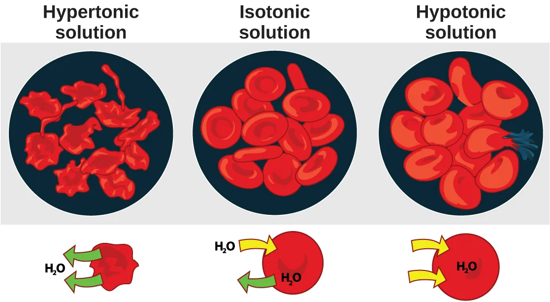 The left part of this illustration shows shriveled red blood cells bathed in a hypertonic solution. The middle part shows healthy red blood cells bathed in an isotonic solution, and the right part shows bloated red blood cells bathed in a hypotonic solution. One of the bloated cells in the hypotonic solution bursts.