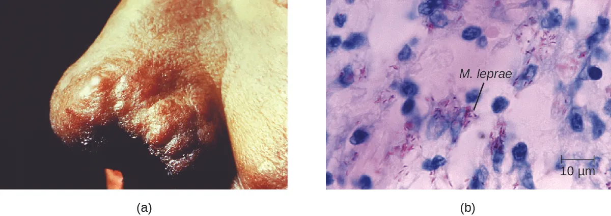 a) Black tissue on end of nose. B) Small purple cells next to larger blue ones.