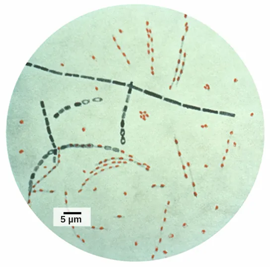 A light microscope photo of the long rods of anthrax bacterium. Several lines of red spore dots can be seen as well.