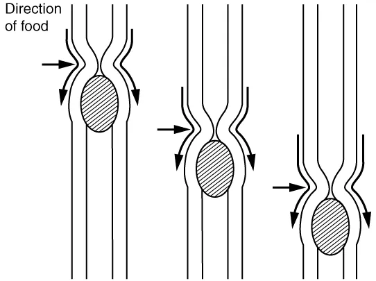 This image shows the peristaltic movement of food. In the left image, the food bolus is towards the top of the esophagus and arrows pointing downward show the direction of movement of the peristaltic wave. In the center image, the food bolus and the wave movement are closer to the center of the esophagus and in the right image, the bolus and the wave are close to the bottom end of the esophagus.