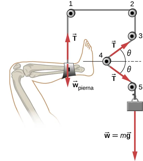 La figura muestra una pierna a la izquierda. Se sujeta a una cuerda en el tobillo y se suspende de una polea en la parte superior. La cuerda continúa hasta una segunda polea a la derecha de la primera, una tercera al fondo de la segunda, una cuarta al fondo a la izquierda de la tercera y una quinta al fondo a la derecha de la cuarta. Un objeto con peso w = mg se sujeta en el extremo de la cuerda. Una flecha marcada como w subíndice pierna apunta hacia abajo desde el tobillo y una flecha marcada como T apunta hacia arriba desde allí. Una flecha marcada como T, desde la cuarta polea hasta la tercera, forma un ángulo theta con la horizontal. Otra flecha marcada como T, desde la cuarta polea hasta la quinta forma un ángulo menos theta con la horizontal.