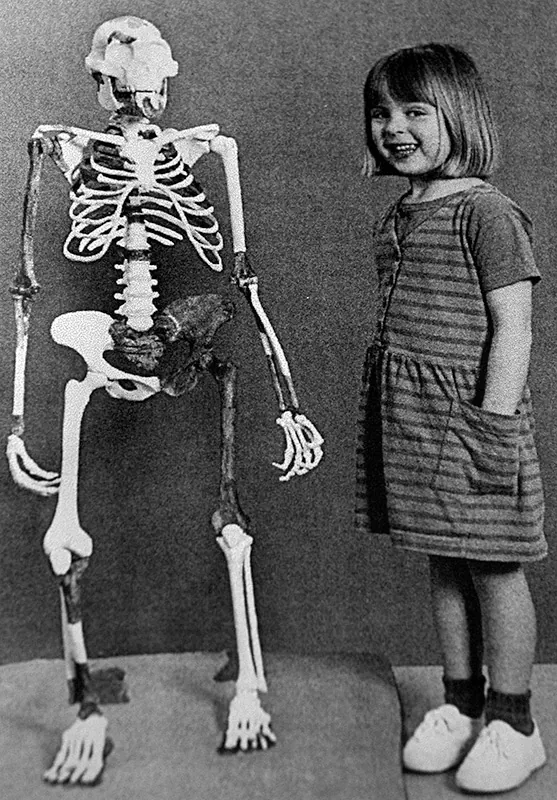 Young girl standing next to a skeleton that is slightly taller than she is. The arms, fingers, and toes of the skeleton are all much longer than those of a human being.