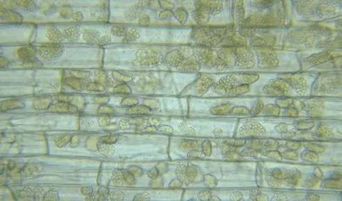 A light micrograph shows resting spores of Barley Yellow Mosaic Virus inside the cells of a plant root. The spores are circular and are clustered into groups within the cell.