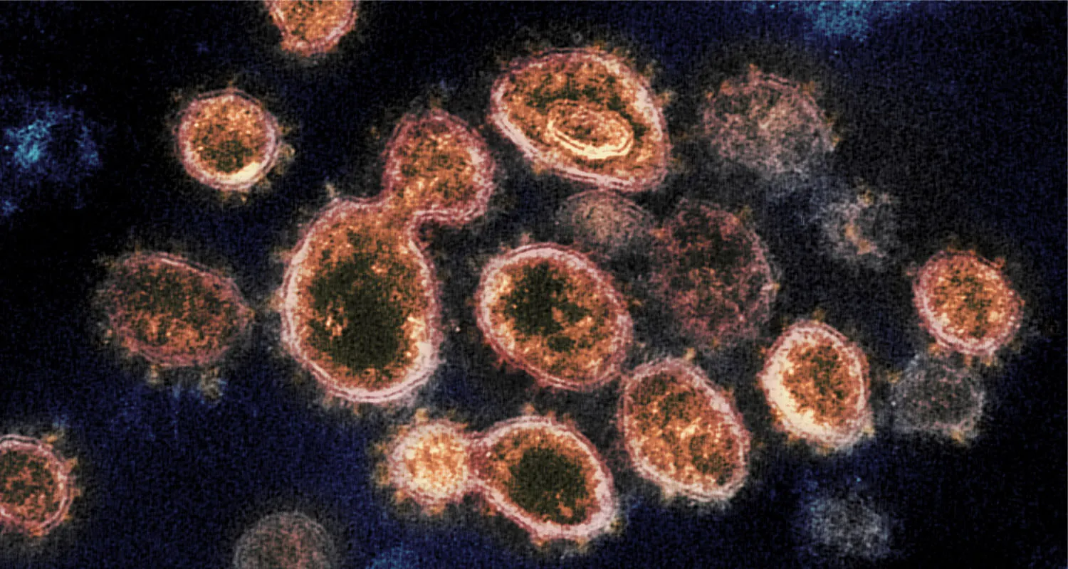 Circular and ovular structures with thin lines on the outside indicating the membrane. The inner portions contain different colors and textures ranging from dense patches of dark substances to lighter and brighter areas. About ten viruses are pictured, with one seeming to separate into two smaller entities.