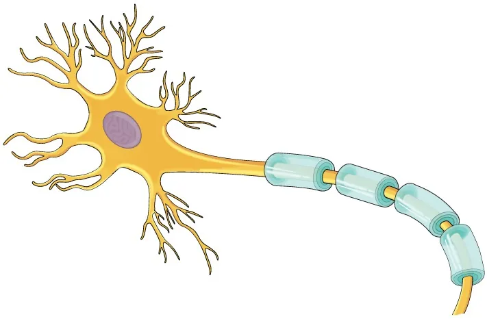 Illustration shows a neuron malformed in that it is lacking axon terminals.