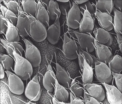 Micrograph of kite-shaped cells with tails