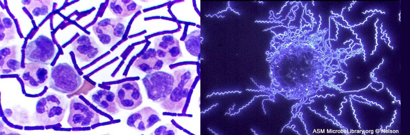 The left image shows a clear background with chains of solid purple rods and larger circular cells. The larger cells contain darker purple blotches inside each cell. The right image shows a black background with thin, glowing spirals.