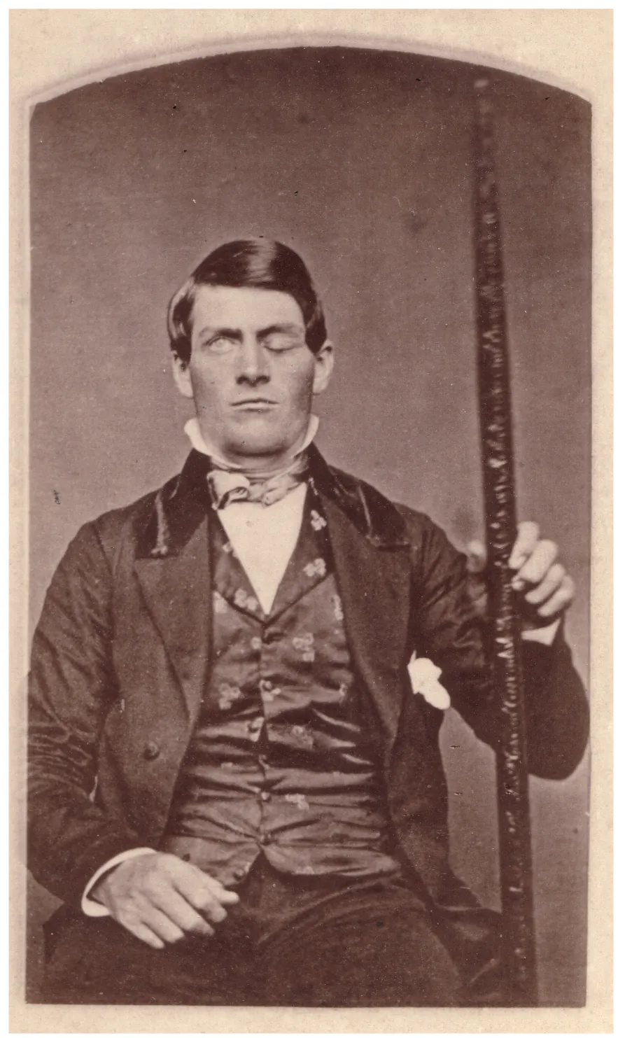 This photo shows Phineas Gage holding the metal spike that impaled his prefrontal cortex.