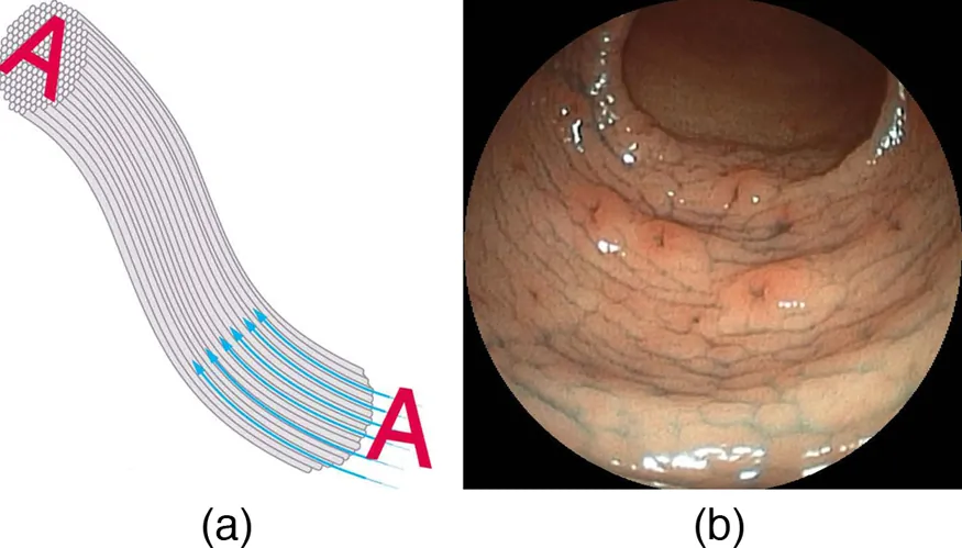Picture (a) shows how an image A is transmitted through a bundle of parallel fibers. Picture (b) shows an endoscope image.