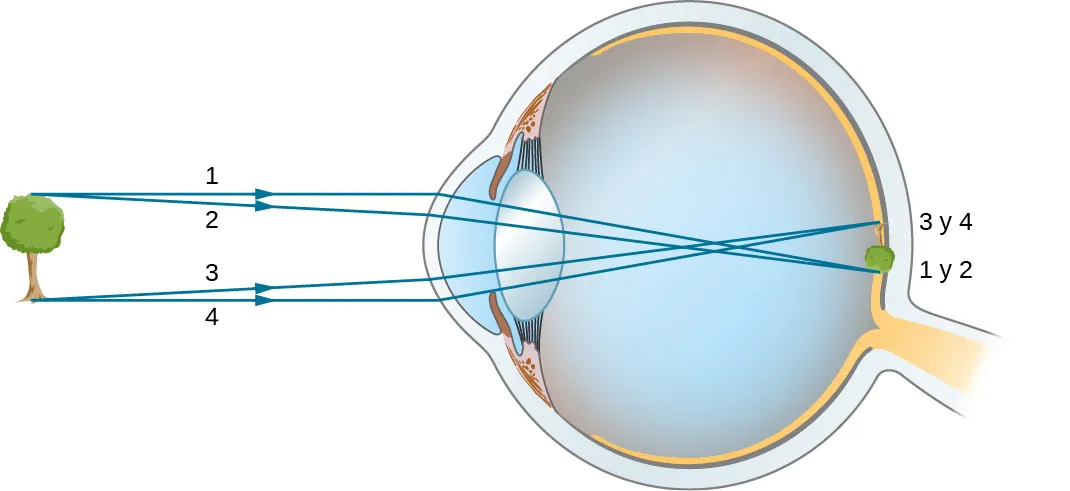 La figura muestra un árbol frente a un ojo. Los rayos de la parte superior e inferior del árbol inciden en la córnea del ojo. Se refractan, se cruzan en medio del humor vítreo y llegan a la retina. La imagen que se forma en la retina es diminuta e invertida.