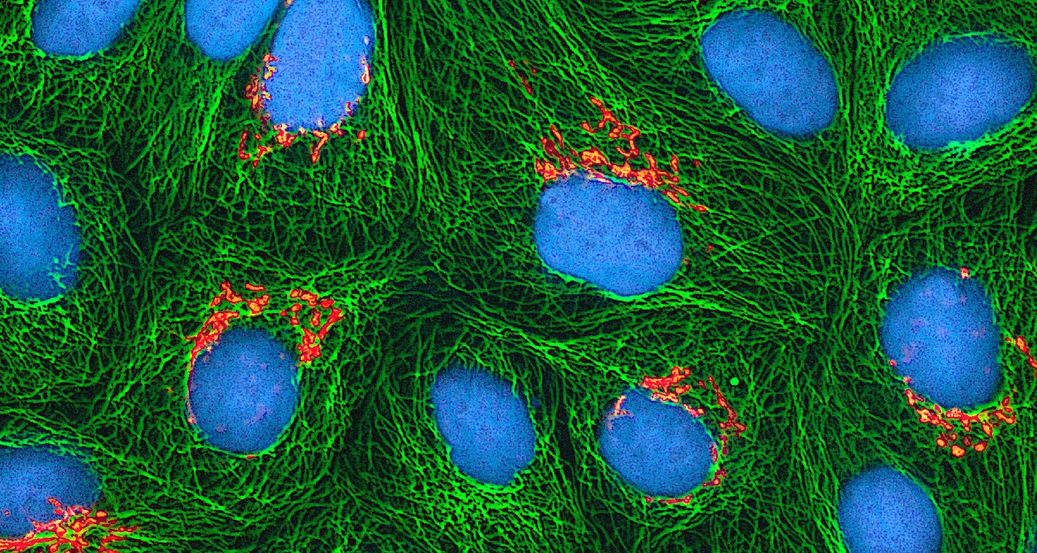 HeLa cells