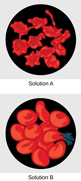 Solution A contains shriveled red blood cells. Solution B contains bloated red blood cells. One of the bloated cells has burst.