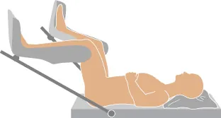 A diagram showing the lithotomy position.