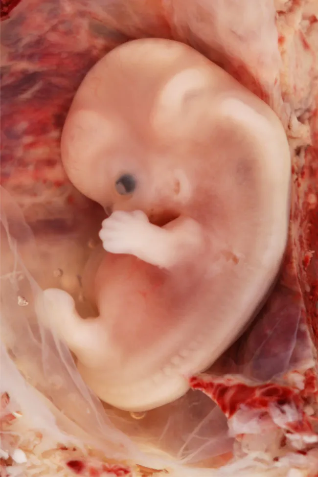 Fetus at nine weeks of gestation