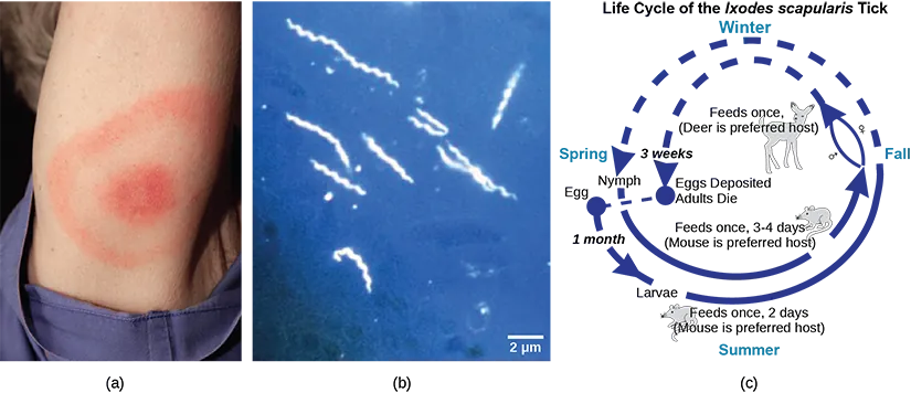 Part A shows the red, bullseye-shaped rash of a person infected with Borrelia. Part B shows a micrograph of Borrelia, which look like tiny corkscrews. Part C shows the life cycle of the bacteria, which begins when Borrelia infect a tick egg. The egg hatches into larva, which feeds on a mouse, then into a nymph, which also feeds on a mouse. The nymph feeds again, this time on a deer, or sometimes a human.