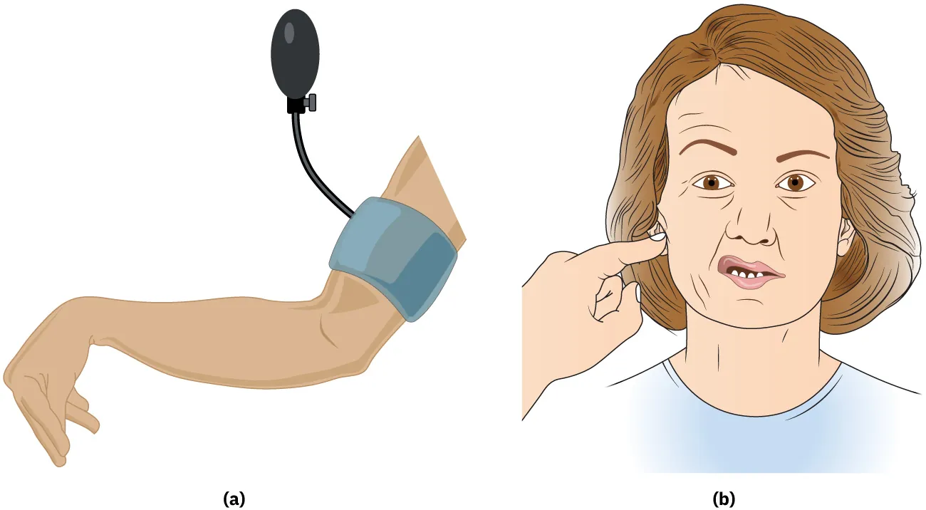A color graphic showing a positive Chvostek's sign and a Trousseau's sign. The Chostek's sign depicts an arm with the hand bent down and a bloodpressure band on the upper arm. The Trousseau's sign depicts a woman's face with the right side distorted and a hand reaching to the right ear.