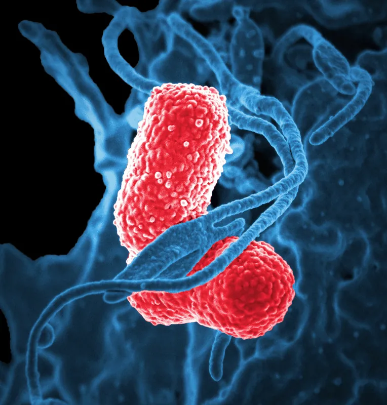 Bacteria viewed through a microscope.