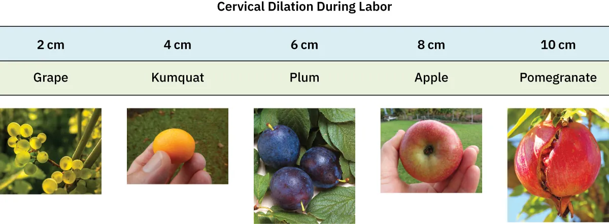 Chart depicting size comparisons of cervix dilation during labor: 2 cm = Grape; 4 cm: Kumquat; 6 cm: Plum; 8 cm: Apple: 10 cm: Pomegranate