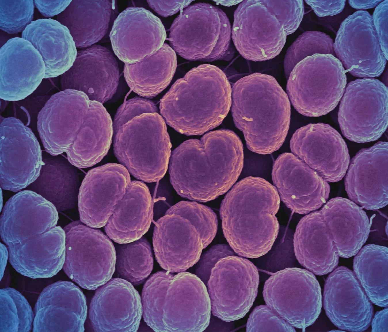 Scanning electron micrograph of Neisseria gonorrhoeae bacteria, which causes gonorrhea.