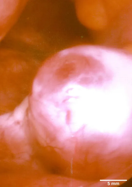 Micrograph shows a spherical egg growing on the surface of a tissue.