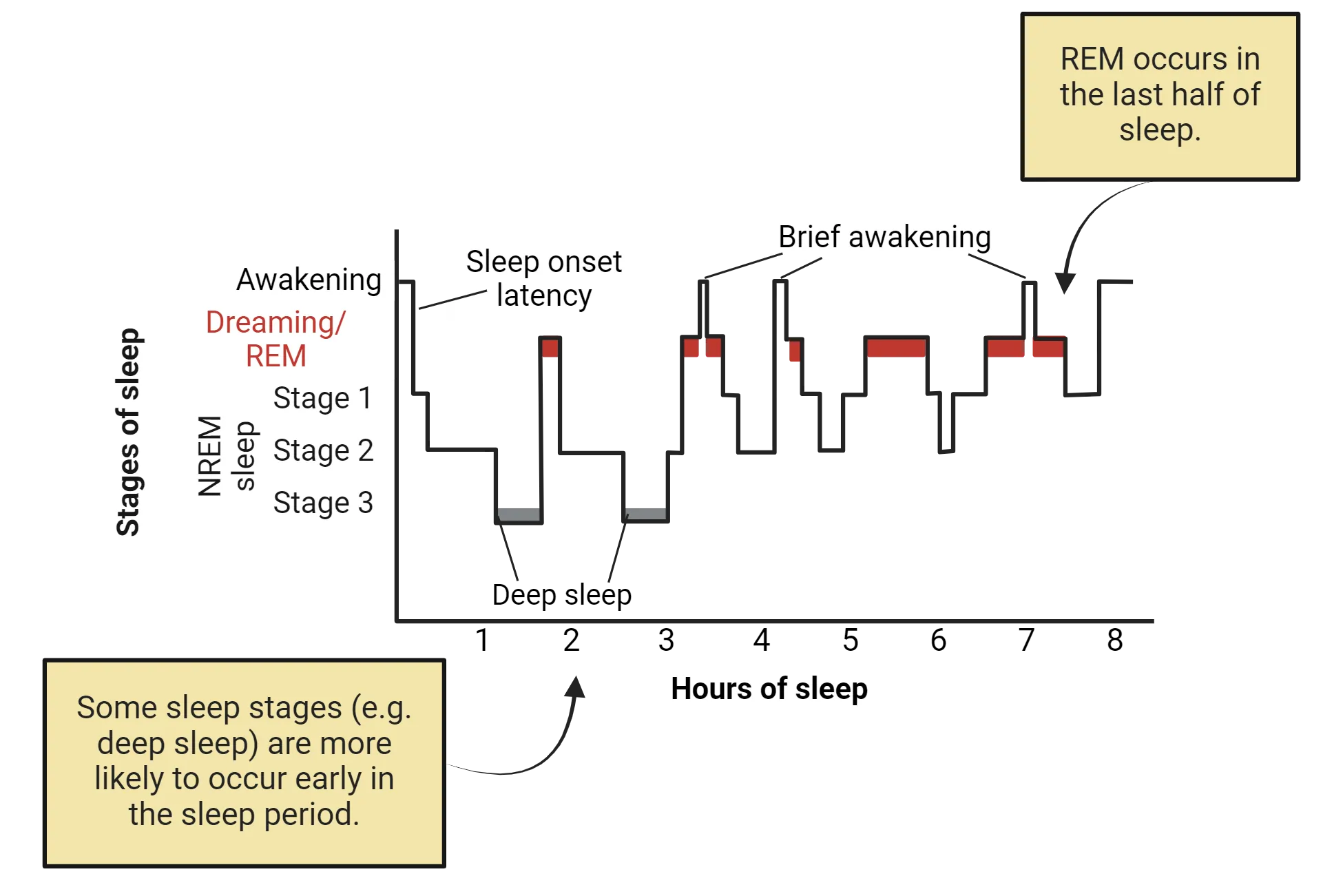 A graphical display of sleep stages with Y-axis being stages of sleep (top to bottom: awake; dreaming/REM; NREM stage 1; NREM stage 2; NREM stage 3). X-axis is hours of sleep. A line starts at awake, hour 0 and drops to Stage 2 and 3 within an hour. The line returns to REM then back to stage 3. After 4h, no more stage 3 (also marked deep sleep) happens and there are just repeating cycles of REM or awake to stage 1 or 2.