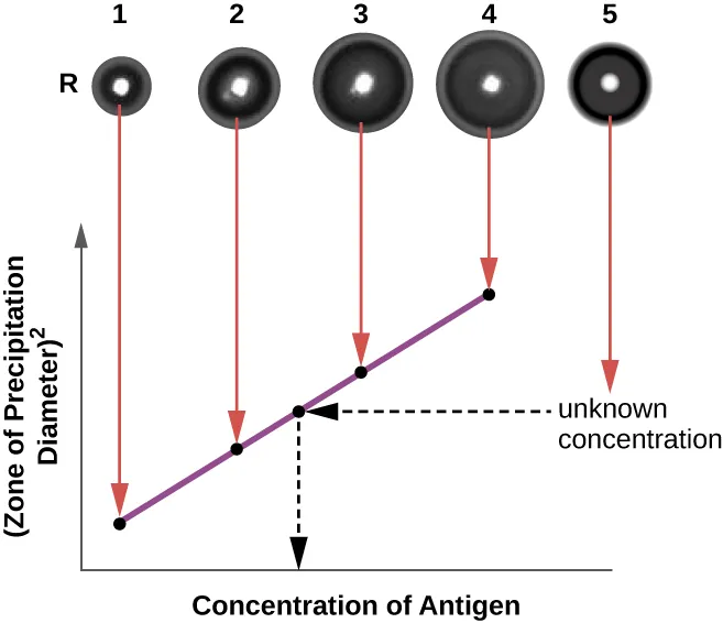 Radial Immunodiffusion Assay. Description below.