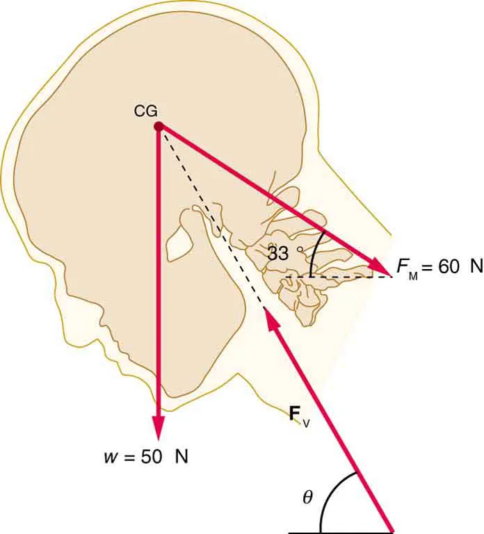 The head of a person working at a drafting board in relaxed position is shown. The inclination of the head is theta to the horizontal and the center of gravity is near the top of the head. The weight of the head is fifty newtons and is acting downward at the center of gravity. Three major forces are shown. The force exerted along the neck is sixty newtons.