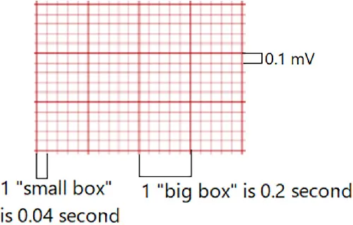 An image of ECG graph paper.