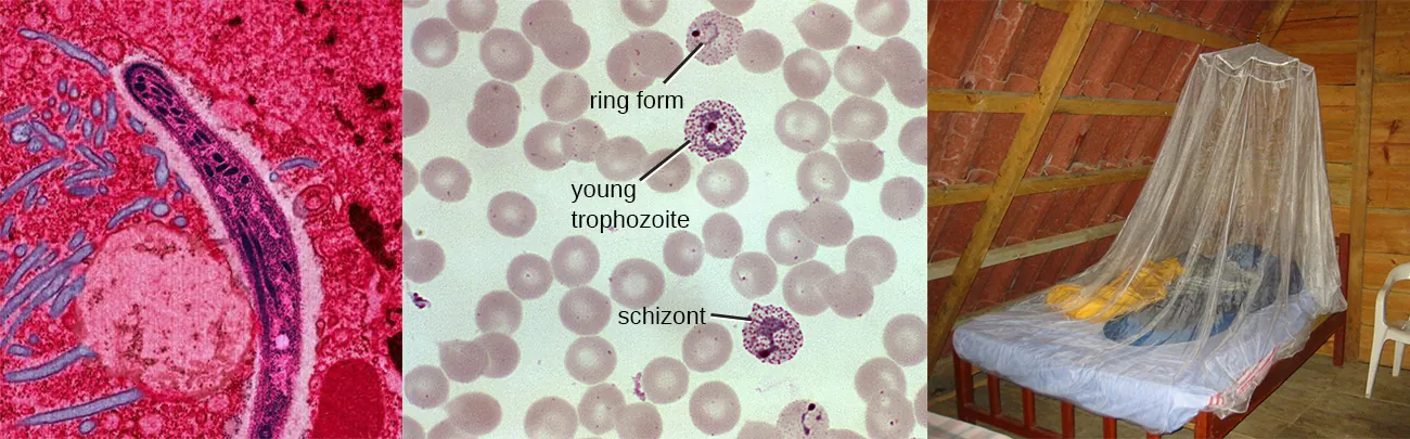 Malaria. Description below.