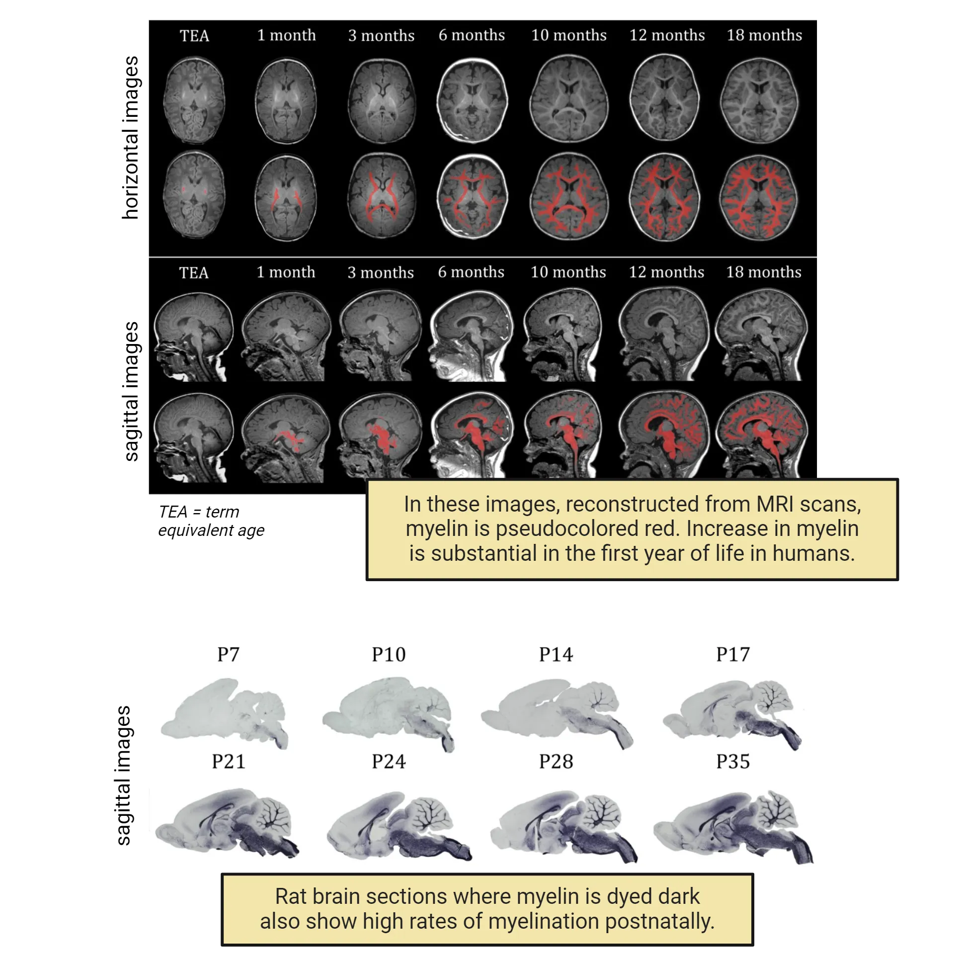  Top shows MRI scans of human brain from brith to 18 months. Pseuodcoloring is used to show that the increase in myelin is substantial in the first year of life in humans. Bottom shows stained rat brain sections where darkly-stained myelin becomes more and more evident from postnatal day 7 to day 35.